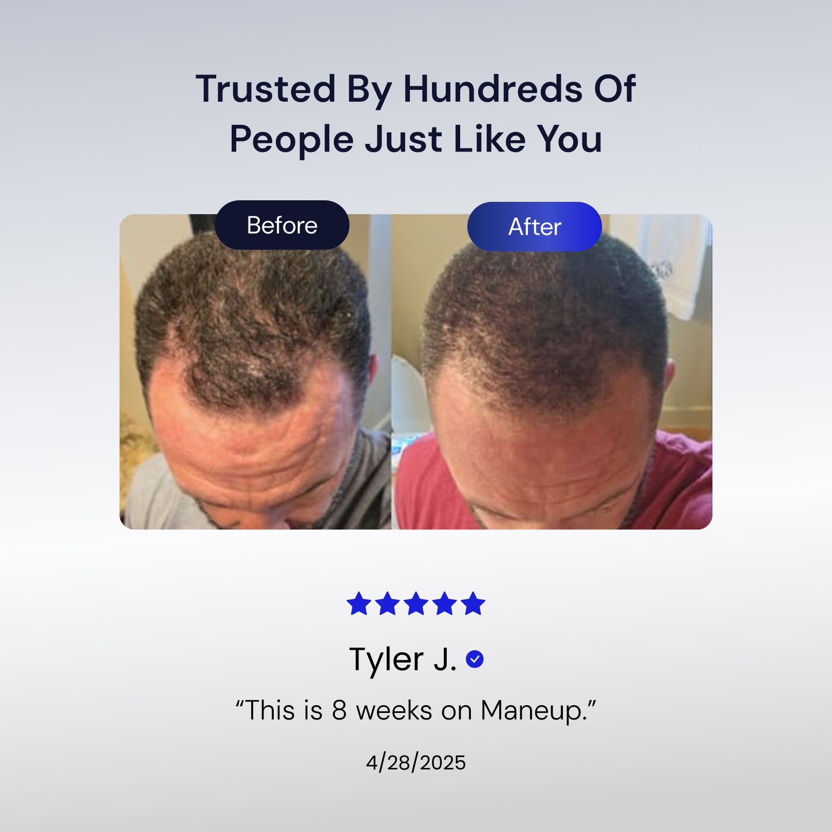 Peptide Powered Hair Regrowth Serum