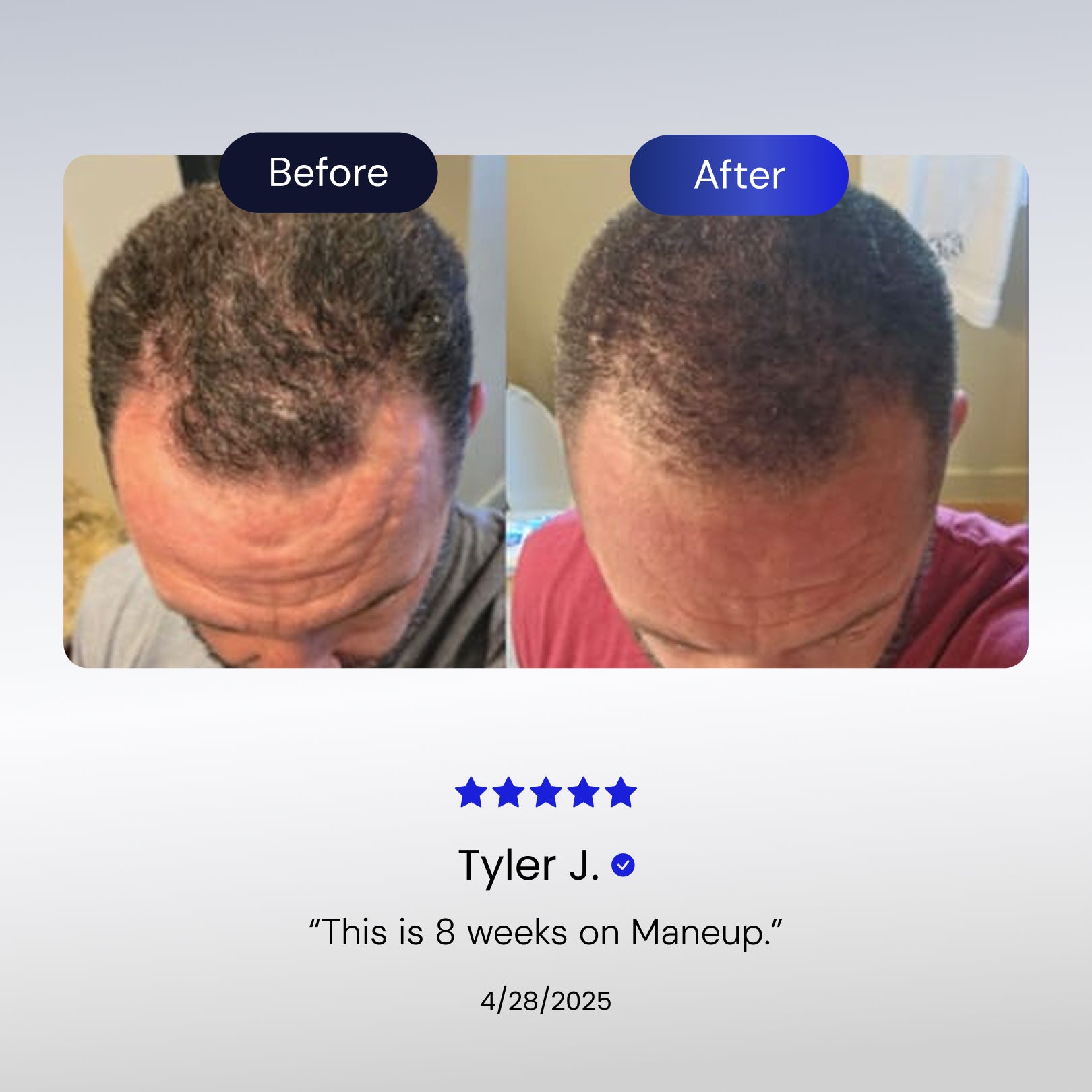 Hair Restoration Serum | Advanced GHK-Cu Copper Peptide Formula